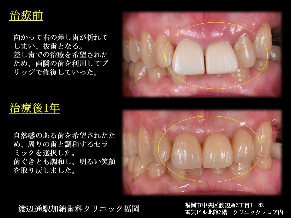写真5