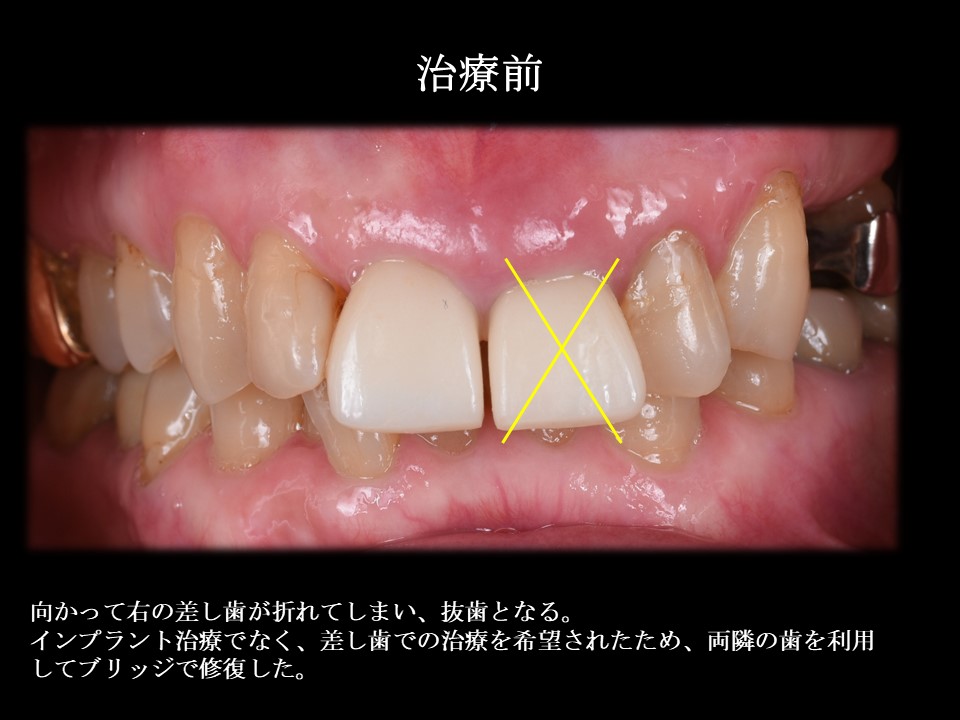 写真2