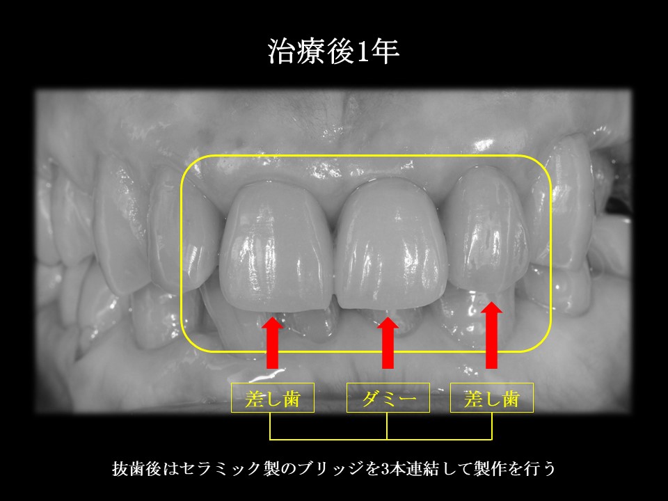 写真4