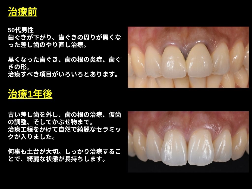 写真2