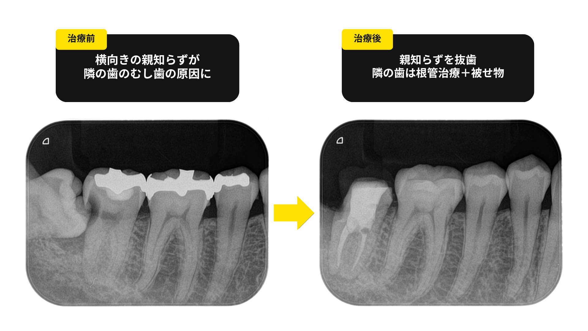 写真4